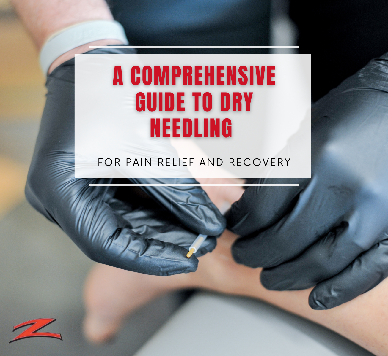 Dry needling treatment at Zarett Rehab